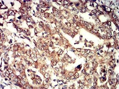 Immunohistochemistry: Neutrophil Elastase/ELA2 Antibody (6B6B10) - BSA Free [NBP2-61658]