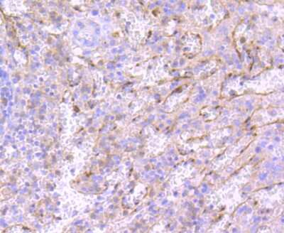 Immunohistochemistry-Paraffin: Neutrophil Elastase/ELA2 Antibody (JF098-6) [NBP2-66972]