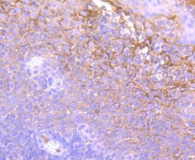 Immunohistochemistry-Paraffin: Neutrophil Elastase/ELA2 Antibody (JF098-6) [NBP2-66972]