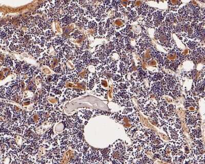 Immunohistochemistry-Paraffin: Neutrophil Elastase/ELA2 Antibody (JF098-6) [NBP2-66972]