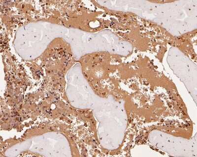 Immunohistochemistry-Paraffin: Neutrophil Elastase/ELA2 Antibody (JF098-6) [NBP2-66972]