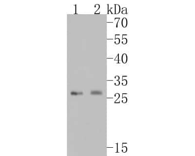 Western Blot: Neutrophil Elastase/ELA2 Antibody (JF098-6) [NBP2-66972]