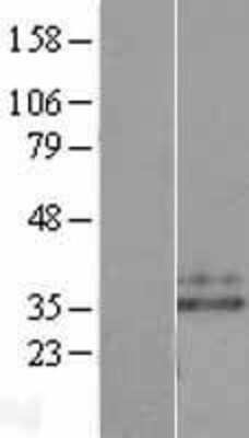 Western Blot: Neutrophil Elastase/ELA2 Overexpression Lysate [NBL1-10217]