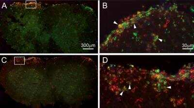 Immunocytochemistry/ Immunofluorescence: Neutrophils Antibody (RM0028-3G23) - Azide and BSA Free [NBP2-12439]