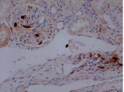 Immunohistochemistry-Paraffin: Neutrophils Antibody (RM0028-3G23) - Azide and BSA Free [NBP2-12439]