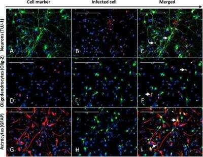 Immunocytochemistry/ Immunofluorescence: Newcastle Disease Virus (NDV) Antibody (6H12) [NBP2-11633]