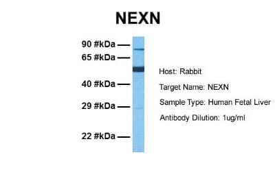 Western Blot: Nexilin Antibody [NBP1-53226]