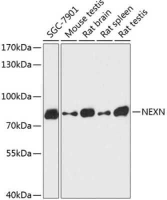 Western Blot: Nexilin AntibodyAzide and BSA Free [NBP2-93780]