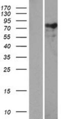 Western Blot: Nexilin Overexpression Lysate [NBP2-05559]