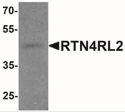 Western Blot: NgR2/NgRH1/RTN4RL2 AntibodyBSA Free [NBP2-41200]