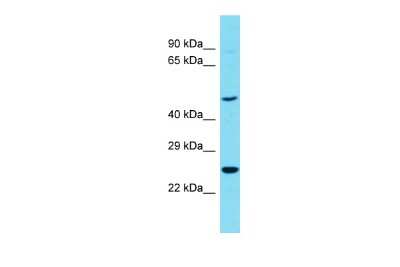 Western Blot: NgR3/NgRH2/RTN4RL1 Antibody [NBP3-09588]