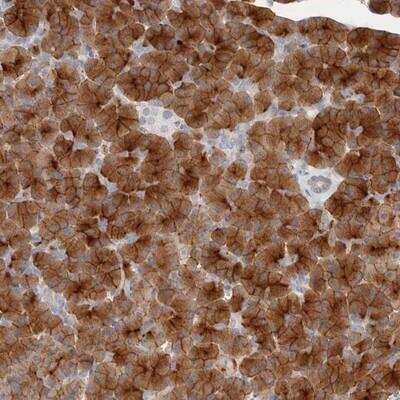 Immunohistochemistry: Niban Antibody [NBP1-88340]