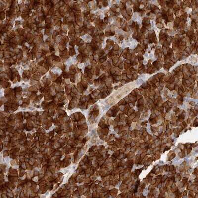 Immunohistochemistry-Paraffin: Niban Antibody [NBP1-88338]