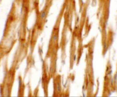 Immunohistochemistry: Nicalin Antibody - BSA Free [NBP2-81860]