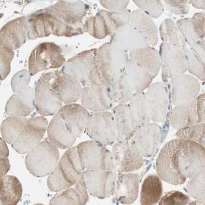 Immunohistochemistry-Paraffin: Nicalin Antibody [NBP1-81002]