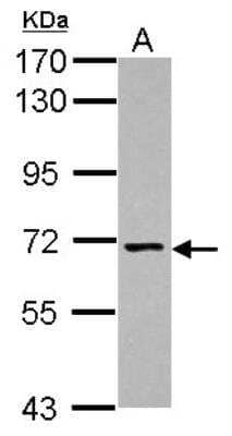 Western Blot: Nicalin Antibody [NBP2-19493]