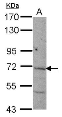 Western Blot: Nicalin Antibody [NBP2-19494]