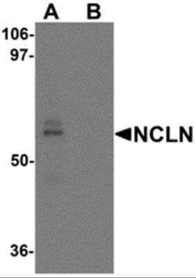 Western Blot: Nicalin AntibodyBSA Free [NBP2-81860]