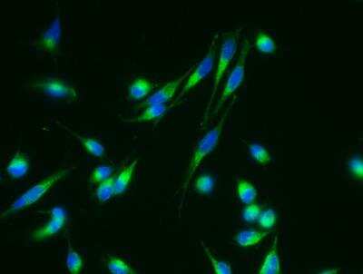 Immunocytochemistry/ Immunofluorescence: Nicastrin Antibody (004) [NBP2-89826]