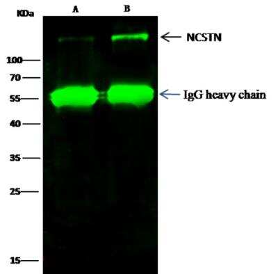 Immunoprecipitation: Nicastrin Antibody (019) [NBP2-89828]