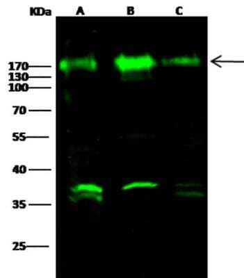 Western Blot: Nicastrin Antibody (019) [NBP2-89828]