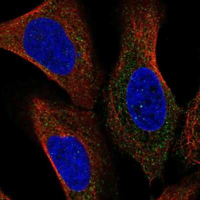 Immunocytochemistry/ Immunofluorescence: Nicastrin Antibody [NBP2-57365]