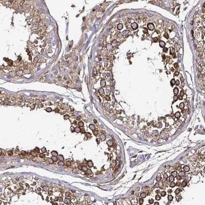 Immunohistochemistry: Nicastrin Antibody [NBP2-38741]