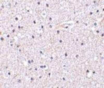 Immunohistochemistry-Paraffin: Nicastrin Antibody - BSA Free [NBP1-77269]