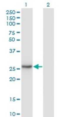 Western Blot: Nicotinamide N-Methyltransferase/NNMT Antibody (2F2) [H00004837-M03]