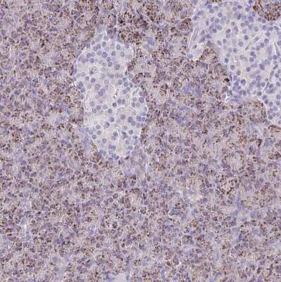 Immunohistochemistry-Paraffin: Nicotinamide N-Methyltransferase/NNMT Antibody [NBP2-32438]