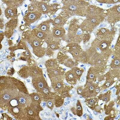 Immunohistochemistry-Paraffin: Nicotinamide N-Methyltransferase/NNMT Antibody - Azide and BSA Free [NBP3-03406]