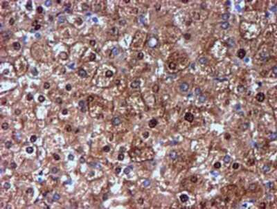 Immunohistochemistry: Nicotinamide N-Methyltransferase/NNMT Antibody (OTI3D8) - Azide and BSA Free [NBP2-72984]
