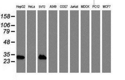 Western Blot: Nicotinamide N-Methyltransferase/NNMT Antibody (OTI3D8)Azide and BSA Free [NBP2-72984]