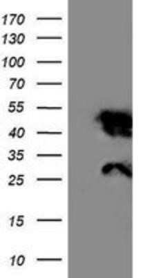 Western Blot: Nicotinamide N-Methyltransferase/NNMT Antibody (OTI3D8)Azide and BSA Free [NBP2-72984]