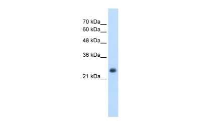 Western Blot: Nicotinamide N-Methyltransferase/NNMT Antibody [NBP1-55398]