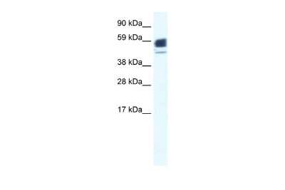 Western Blot: Nicotinic Acetylcholine R alpha 1/CHRNA1 Antibody [NBP2-85379]