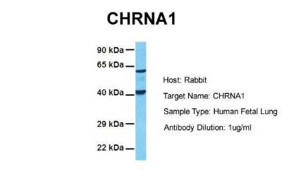 Western Blot: Nicotinic Acetylcholine R alpha 1/CHRNA1 Antibody [NBP2-85380]