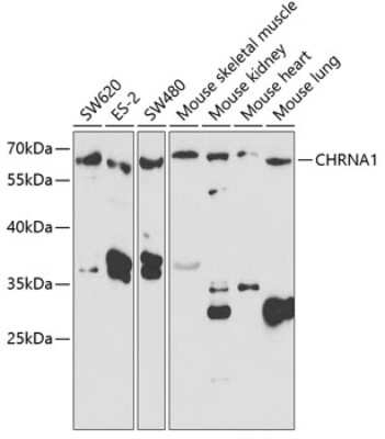 Western Blot: Nicotinic Acetylcholine R alpha 1/CHRNA1 AntibodyBSA Free [NBP2-93514]