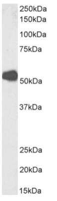 Western Blot: Nicotinic Acetylcholine R alpha 1/CHRNA1 Antibody (mAb 192)Azide and BSA Free [NBP2-81070]