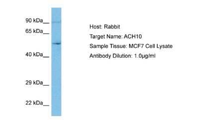 Western Blot: Nicotinic Acetylcholine R alpha 10/CHRNA10 Antibody [NBP2-86729]