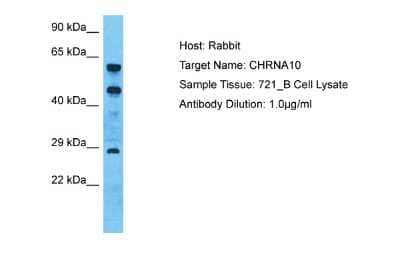 Western Blot: Nicotinic Acetylcholine R alpha 10/CHRNA10 Antibody [NBP2-86730]