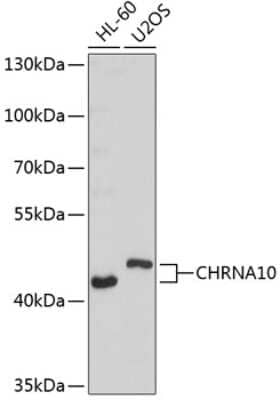 Western Blot: Nicotinic Acetylcholine R alpha 10/CHRNA10 AntibodyBSA Free [NBP2-95190]