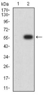 Western Blot: Nicotinic Acetylcholine R alpha 2/CHRNA2 Antibody (7G12H9)BSA Free [NBP2-61667]