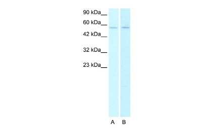 Western Blot: Nicotinic Acetylcholine R alpha 2/CHRNA2 Antibody [NBP1-79957]