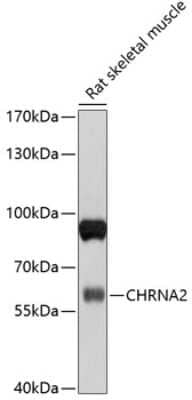 Western Blot: Nicotinic Acetylcholine R alpha 2/CHRNA2 AntibodyBSA Free [NBP2-94552]