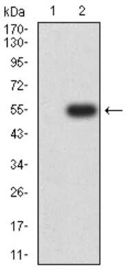 Western Blot: Nicotinic Acetylcholine R alpha 3/CHRNA3 Antibody (6D3A10)BSA Free [NBP2-61673]