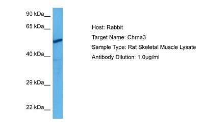 Western Blot: Nicotinic Acetylcholine R alpha 3/CHRNA3 Antibody [NBP2-87918]