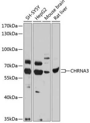 Western Blot: Nicotinic Acetylcholine R alpha 3/CHRNA3 AntibodyBSA Free [NBP2-94776]