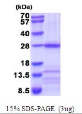 SDS-PAGE: Recombinant Human Nicotinic Acetylcholine R alpha 3/CHRNA3 His Protein [NBP2-52109]