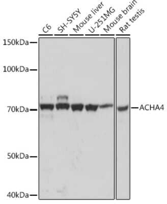 Western Blot: Nicotinic Acetylcholine R alpha 4/CHRNA4 Antibody (1C2H2) [NBP3-15260]